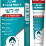 Lee más sobre el artículo <a href="https://amazon.es/dp/B0F92HGFB5?tag=techbeautydeals-21" target="_blank">Tratamiento rápido para el acné, reduce imperfecciones, ideal para piel sensible.</a>